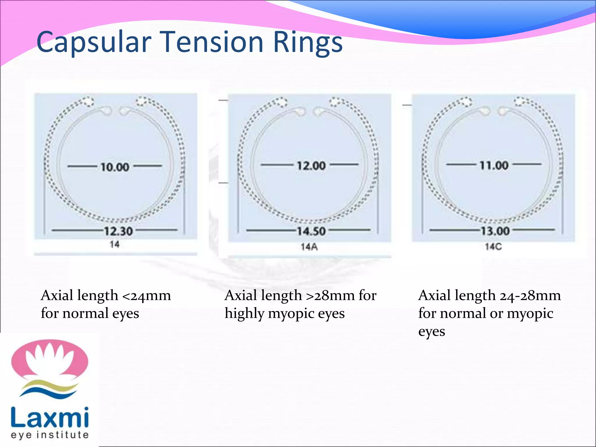 Capsular Tension Rings
Axial length <24mm
for normal eyes
Axial length >28mm for
highly myopic eyes
Axial length 24-28mm
for normal or myopic
eyes
 