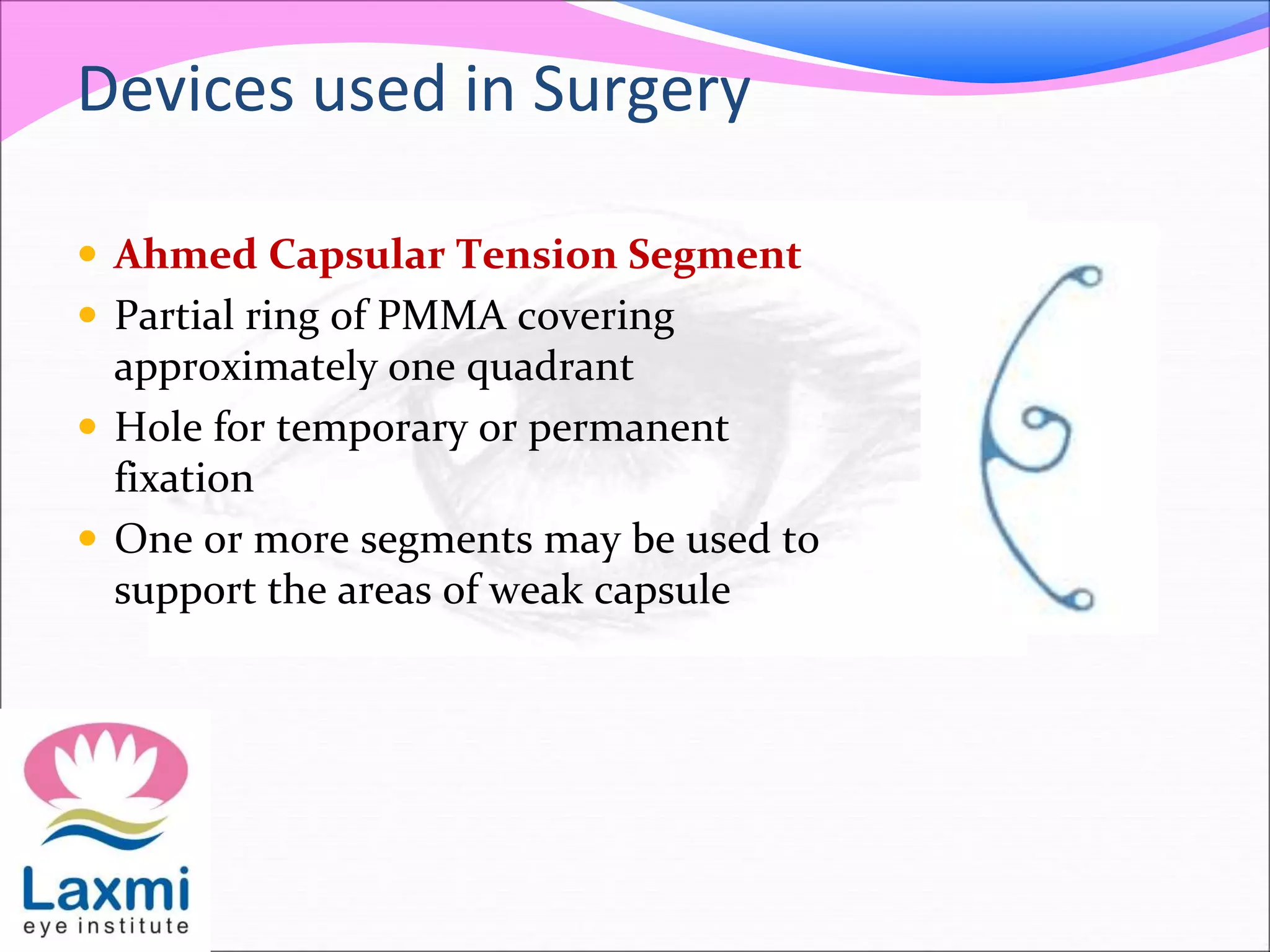  Ahmed Capsular Tension Segment
 Partial ring of PMMA covering
approximately one quadrant
 Hole for temporary or permanent
fixation
 One or more segments may be used to
support the areas of weak capsule
Devices used in Surgery
 