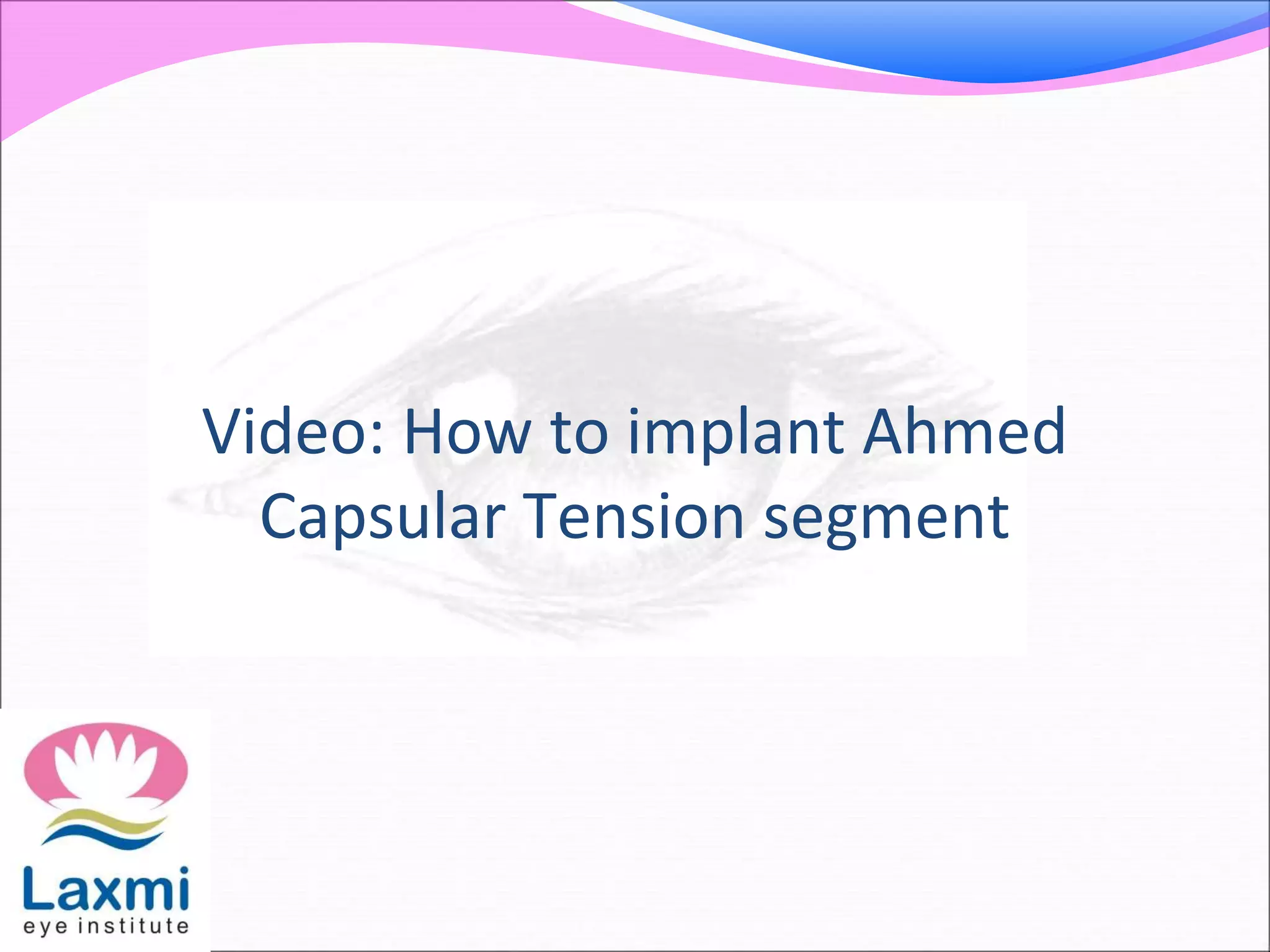 Video: How to implant Ahmed
Capsular Tension segment
 