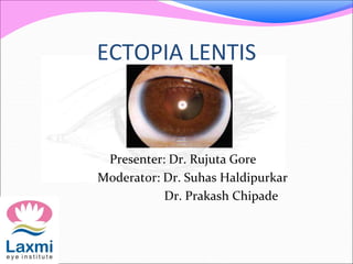 ECTOPIA LENTIS
Presenter: Dr. Rujuta Gore
Moderator: Dr. Suhas Haldipurkar
Dr. Prakash Chipade
 