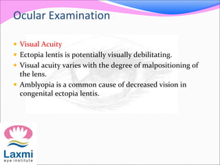 Ocular Examination
 Visual Acuity
 Ectopia lentis is potentially visually debilitating.
 Visual acuity varies with the degree of malpositioning of
the lens.
 Amblyopia is a common cause of decreased vision in
congenital ectopia lentis.
 