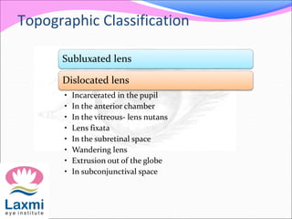 Topographic Classification
Subluxated lens
Dislocated lens
• Incarcerated in the pupil
• In the anterior chamber
• In the vitreous- lens nutans
• Lens fixata
• In the subretinal space
• Wandering lens
• Extrusion out of the globe
• In subconjunctival space
 