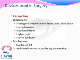 Devices used in Surgery
 Cionni Ring
 Indications:
 Missing or damaged zonules larger than 4 clock hours
 Lens subluxation
 Pseudoexfoliation
 High myopia
 Marfan Syndrome
 Mechanism:
 Similar to CTR
 Additionally corrects capsular bag decentration
 