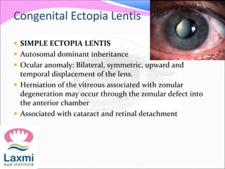 Congenital Ectopia Lentis
 SIMPLE ECTOPIA LENTIS
 Autosomal dominant inheritance
 Ocular anomaly: Bilateral, symmetric,...