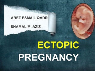 AREZ ESMAIL QADR       SHAMAL M. AZIZ ECTOPIC PREGNANCY 