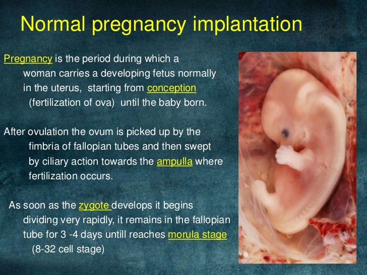 what-is-bleeding-like-with-ectopic-pregnancy-pregnancywalls
