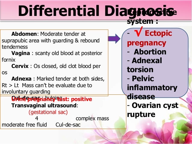 Download Adnexal Tenderness Pictures