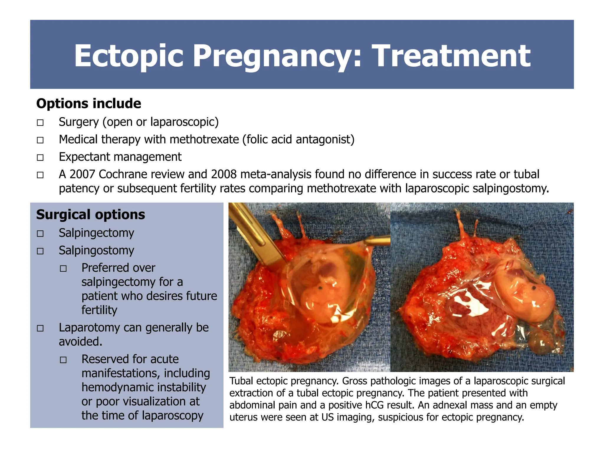 Options include
 Surgery (open or laparoscopic)
 Medical therapy with methotrexate (folic acid antagonist)
 Expectant management
 A 2007 Cochrane review and 2008 meta-analysis found no difference in success rate or tubal
patency or subsequent fertility rates comparing methotrexate with laparoscopic salpingostomy.
Ectopic Pregnancy: Treatment
Surgical options
 Salpingectomy
 Salpingostomy
 Preferred over
salpingectomy for a
patient who desires future
fertility
 Laparotomy can generally be
avoided.
 Reserved for acute
manifestations, including
hemodynamic instability
or poor visualization at
the time of laparoscopy
Tubal ectopic pregnancy. Gross pathologic images of a laparoscopic surgical
extraction of a tubal ectopic pregnancy. The patient presented with
abdominal pain and a positive hCG result. An adnexal mass and an empty
uterus were seen at US imaging, suspicious for ectopic pregnancy.
 