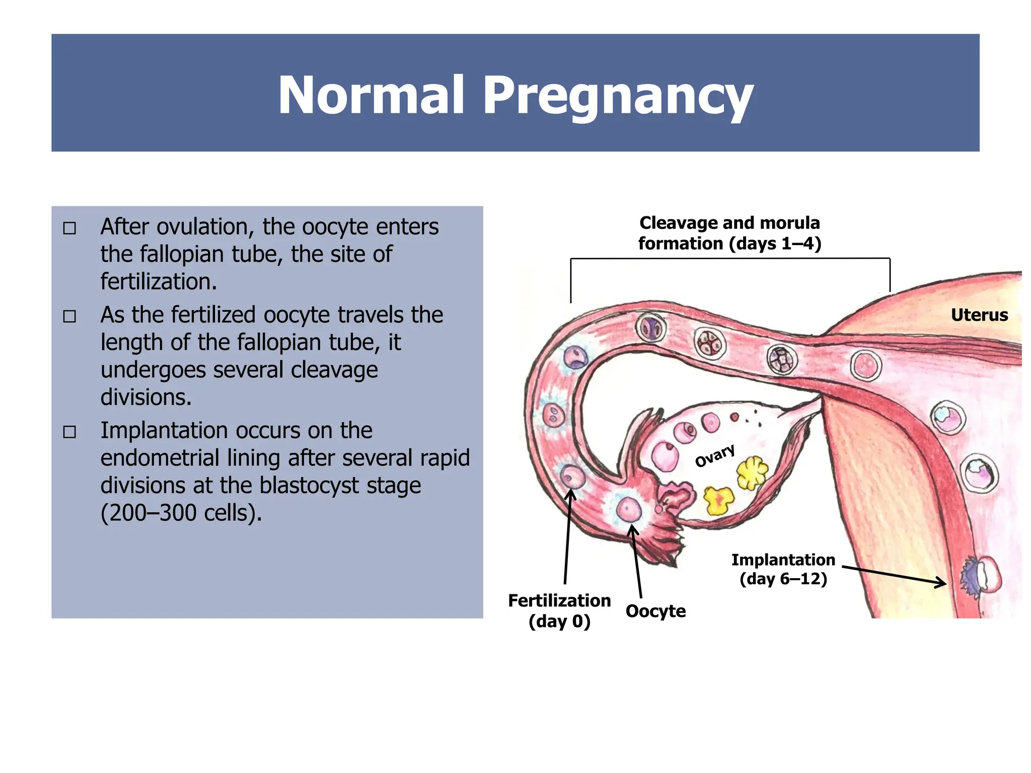 Normal Pregnancy
 After ovulation, the oocyte enters
the fallopian tube, the site of
fertilization.
 As the fertilized oocyte travels the
length of the fallopian tube, it
undergoes several cleavage
divisions.
 Implantation occurs on the
endometrial lining after several rapid
divisions at the blastocyst stage
(200–300 cells).
Fertilization
(day 0)
Uterus
Cleavage and morula
formation (days 1–4)
Implantation
(day 6–12)
Oocyte
 