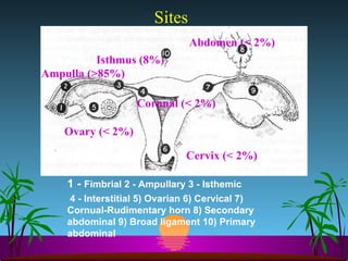 Sites 1 -  Fimbrial 2 - Ampullary 3 - Isthemic 4 - Interstitial 5) Ovarian 6) Cervical 7) Cornual-Rudimentary horn 8) Secondary abdominal 9) Broad ligament 10) Primary abdominal Ampulla (>85%) Isthmus (8%) Cornual (< 2%) Ovary (< 2%) Abdomen (< 2%) Cervix (< 2%) 