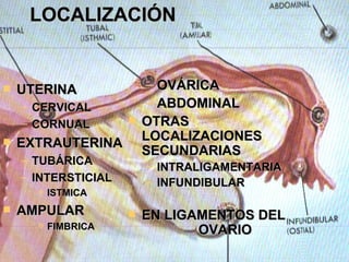 UTERINA CERVICAL CORNUAL EXTRAUTERINA TUBÁRICA INTERSTICIAL ISTMICA AMPULAR FIMBRICA LOCALIZACIÓN   OVÁRICA ABDOMINAL OTRAS LOCALIZACIONES SECUNDARIAS INTRALIGAMENTARIA INFUNDIBULAR EN LIGAMENTOS DEL  OVARIO 
