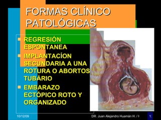 FORMAS CLÍNICO PATOLÓGICAS REGRESIÓN ESPONTANEA IMPLANTACÍON SECUNDARIA A UNA ROTURA O ABORTOS TUBÁRIO EMBARAZO ECTÓPICO ROTO Y ORGANIZADO 