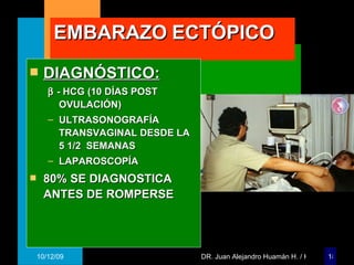 EMBARAZO   ECTÓPICO DIAGNÓSTICO:    - HCG (10 DÍAS POST OVULACIÓN) ULTRASONOGRAFÍA  TRANSVAGINAL DESDE LA 5 1/2  SEMANAS LAPAROSCOPÍA 80% SE DIAGNOSTICA ANTES DE ROMPERSE 