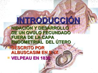 INTRODUCCIÓN NIDACIÓN Y DESARROLLO DE UN OVULO FECUNDADO FUERA DE LA CAPA ENDOMETRIAL  DEL ÚTERO DESCRITO POR ALBUSCASIM EN S. IX VELPEAU EN 1835   