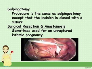 Salpingotomy
Procedure is the same as salpingostomy
except that the incision is closed with a
suture
Surgical Resection & Anastomosis
Sometimes used for an unruptured
isthmic pregnancy
 