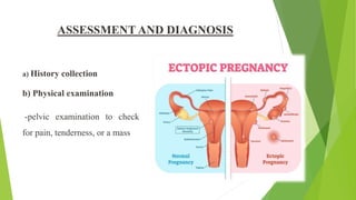 ASSESSMENT AND DIAGNOSIS
a) History collection
b) Physical examination
-pelvic examination to check
for pain, tenderness, or a mass
 