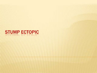 STUMP ECTOPIC

 