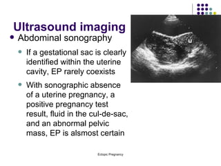 Ultrasound imaging Abdominal sonography If a gestational sac is clearly identified within the uterine cavity, EP rarely coexists With sonographic absence of a uterine pregnancy, a positive pregnancy test result, fluid in the cul-de-sac, and an abnormal pelvic mass, EP is alsmost certain 