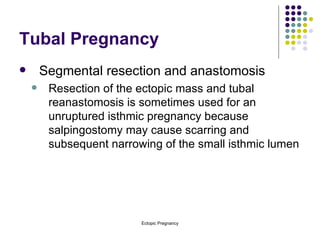 Tubal Pregnancy Segmental resection and anastomosis Resection of the ectopic mass and tubal reanastomosis is sometimes used for an unruptured isthmic pregnancy because salpingostomy may cause scarring and subsequent narrowing of the small isthmic lumen 