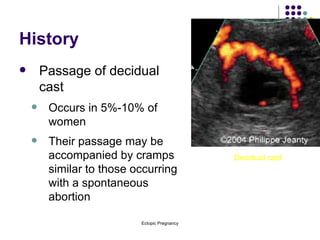 History Passage of decidual cast Occurs in 5%-10% of women Their passage may be accompanied by cramps similar to those occurring with a spontaneous abortion Decidual cast 