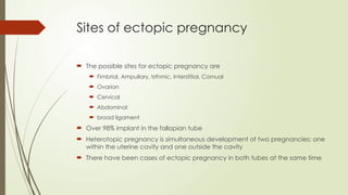 Ectopic Pregnancy overview with diagnosis and investigation. | PPTX