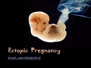 Ectopic  Pregnancy N Engl J Med 2009;361:379-87. 