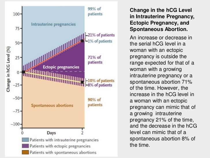 Ectopic Pregnancy