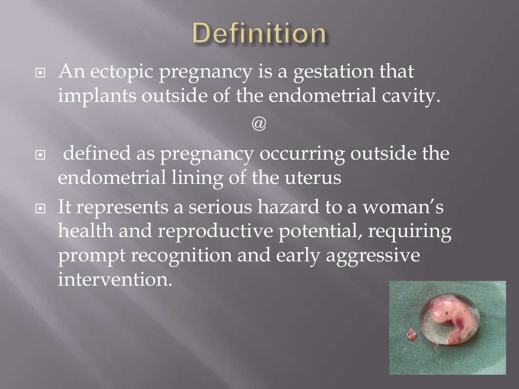 Ectopic pregnancy