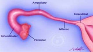 Ectopic pregnancy | PPTX