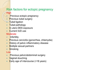 Ectopic pregnancy | PPTX