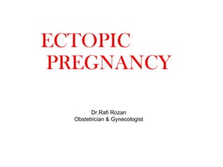 ECTOPIC
PREGNANCY
Dr.Rafi Rozan
Obstetrician & Gynecologist
 