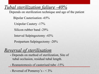 Patss Ectopic pregnancy | PPT