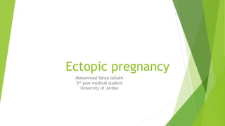 Ectopic pregnancy
Mohammad Yahya tailakh
5th year medical student
University of Jordan
 