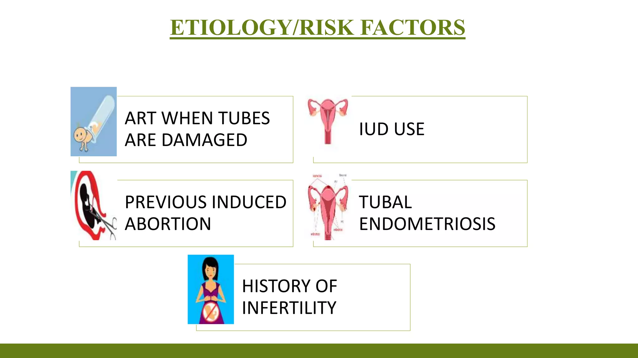 Ectopic pregnancy | PPTX