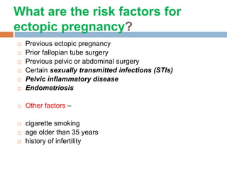 Ectopic pregnancy | PPTX