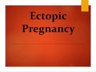 Ectopic
Pregnancy
 