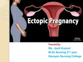 Presentedby:
Ms. Jyoti Kumari
M.Sc Nursing 2nd year
Narayan Nursing College
 