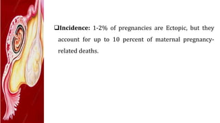 Incidence: 1-2% of pregnancies are Ectopic, but they
account for up to 10 percent of maternal pregnancy-
related deaths.
 