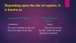 Tune Rupture ECTOPIC PREGNANCY obstetrics and gynaecological nursing | PPTX