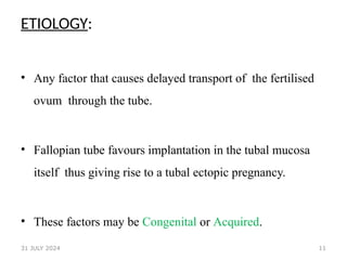 11
ETIOLOGY:
• Any factor that causes delayed transport of the fertilised
ovum through the tube.
• Fallopian tube favours implantation in the tubal mucosa
itself thus giving rise to a tubal ectopic pregnancy.
• These factors may be Congenital or Acquired.
31 JULY 2024
 