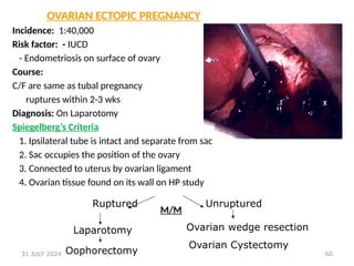 60
OVARIAN ECTOPIC PREGNANCY
Incidence: 1:40,000
Risk factor: - IUCD
- Endometriosis on surface of ovary
Course:
C/F are same as tubal pregnancy
ruptures within 2-3 wks
Diagnosis: On Laparotomy
Spiegelberg’s Criteria
1. Ipsilateral tube is intact and separate from sac
2. Sac occupies the position of the ovary
3. Connected to uterus by ovarian ligament
4. Ovarian tissue found on its wall on HP study
M/M
Ruptured
Laparotomy
Oophorectomy
Unruptured
Ovarian wedge resection
Ovarian Cystectomy
31 JULY 2024
 