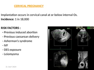 64
CERVICAL PREGNANCY
Implantation occurs in cervical canal at or below internal Os.
Incidence: 1 in 18,000
RISK FACTORS :
- Previous induced abortion
- Previous caesarean delivery
- Asherman’s syndrome
- IVF
- DES exposure
- Leiomyoma
31 JULY 2024
 