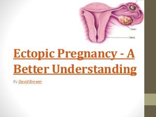 Ectopic Pregnancy - A
Better Understanding
By David Brewer
 