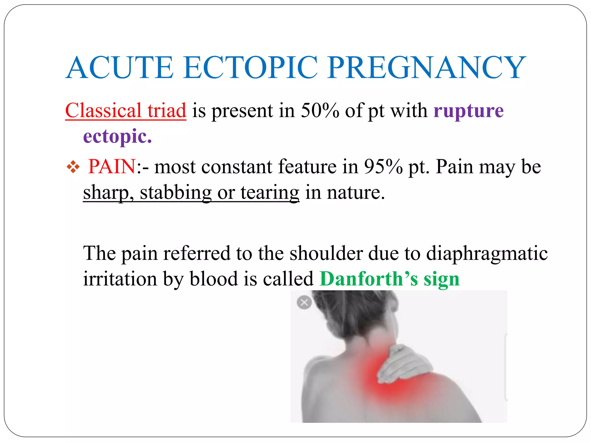 ACUTE ECTOPIC PREGNANCY
Classical triad is present in 50% of pt with rupture
ectopic.
 PAIN:- most constant feature in 95% pt. Pain may be
sharp, stabbing or tearing in nature.
The pain referred to the shoulder due to diaphragmatic
irritation by blood is called Danforth’s sign
 