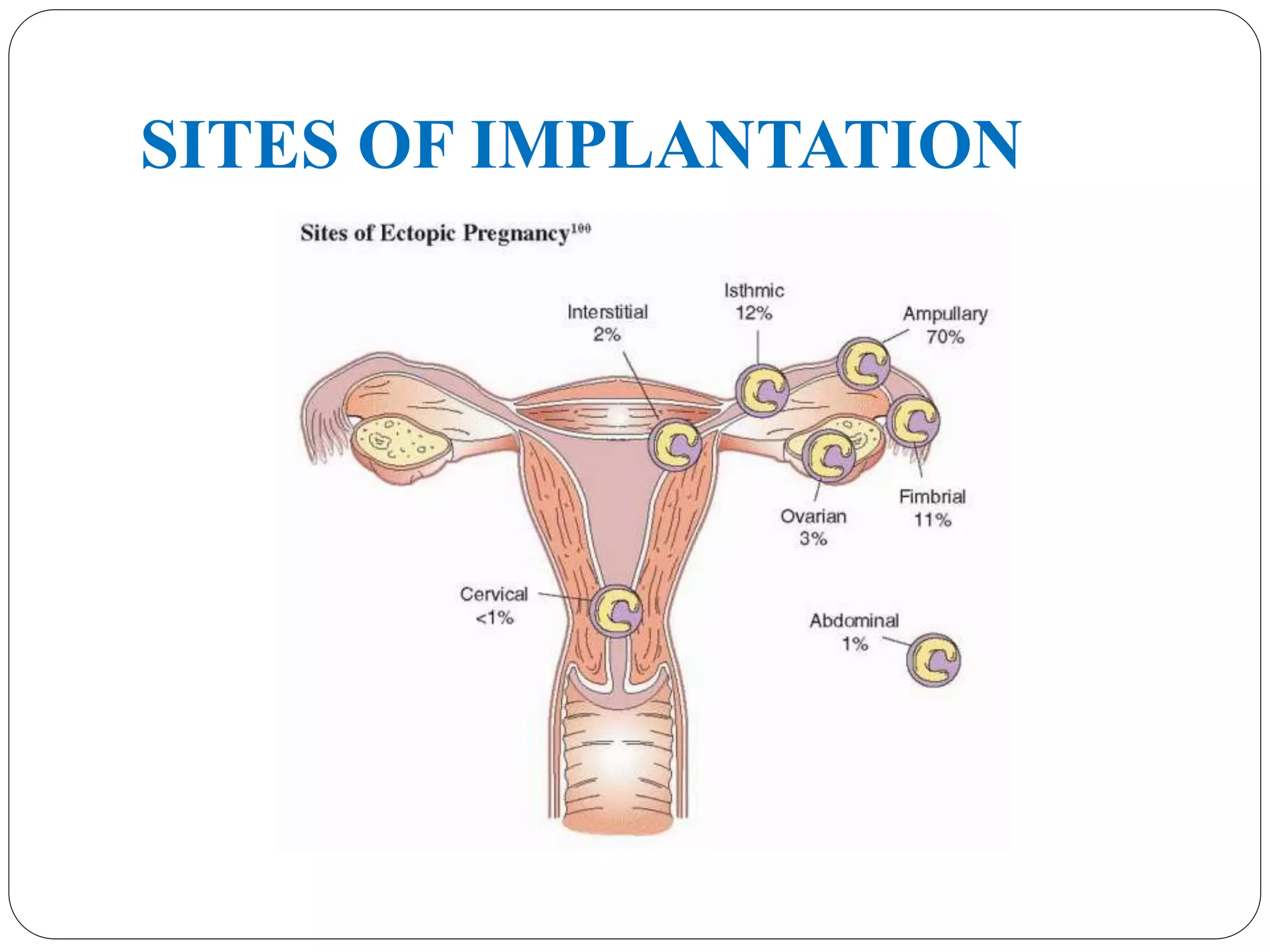 SITES OF IMPLANTATION
 