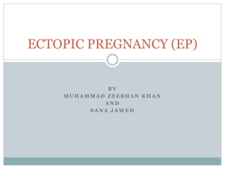 ECTOPIC PREGNANCY (EP) 
BY 
MUHAMMAD ZEESHAN KHAN 
AND 
SANA JAWED 
 