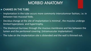 MORBID ANATOMY
 CHANES IN THE TUBE:
• Implantation in the tube occurs more commonly intercolumnar fashion, i.e. in
between two mucosal folds.
• Decidua change at the site of implantation is minimal , the muscles undergo
limited hyperplasia and hypertrophy.
• The blastocyst burrows through the mucous membrane and lies between the
lumen and the peritoneal covering (intramuscular implantation)
• The tube on the implantation site is distended and the wall is thinned out.
 