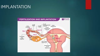 IMPLANTATION
 