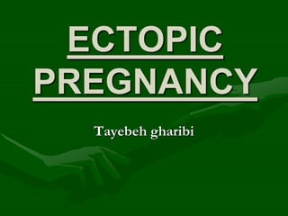 ECTOPIC
PREGNANCY
Tayebeh gharibi
 
