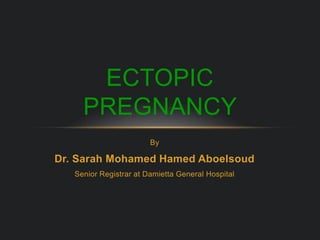 By
Dr. Sarah Mohamed Hamed Aboelsoud
Senior Registrar at Damietta General Hospital
ECTOPIC
PREGNANCY
 